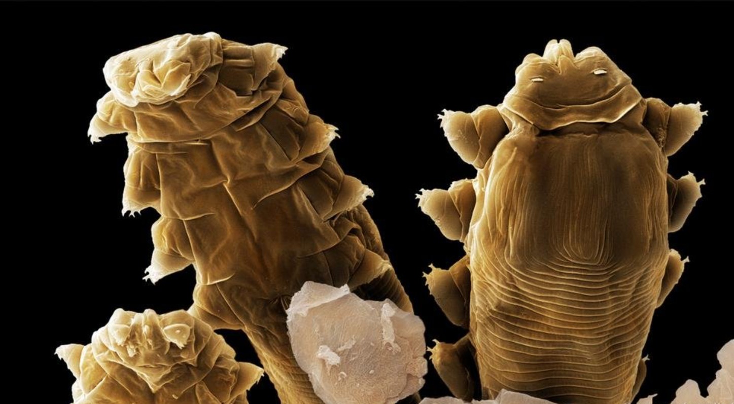 Rận Demodex chuyên ký sinh trên da mặt người, có hình dáng giống sâu nhưng thực chất là loài giáp xác như cua.