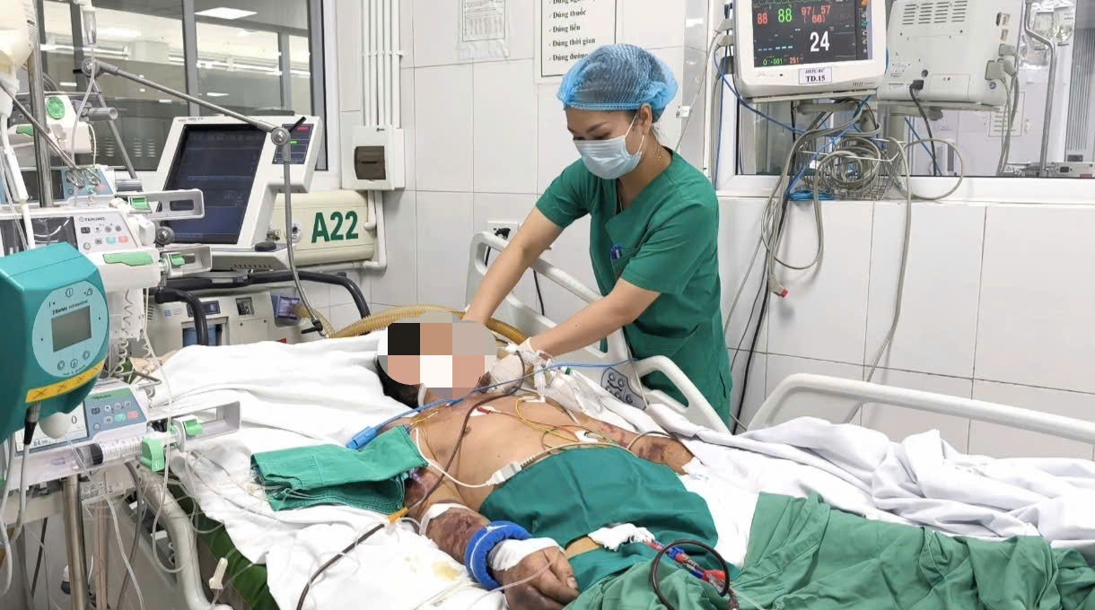 Người đàn ông đang được điều trị tích cực tại Bệnh viện Bệnh Nhiệt đới Trung ương - Ảnh: BVCC