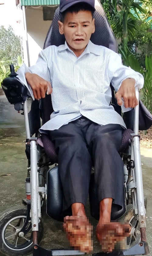 Anh Sơn, người mắc bệnh 