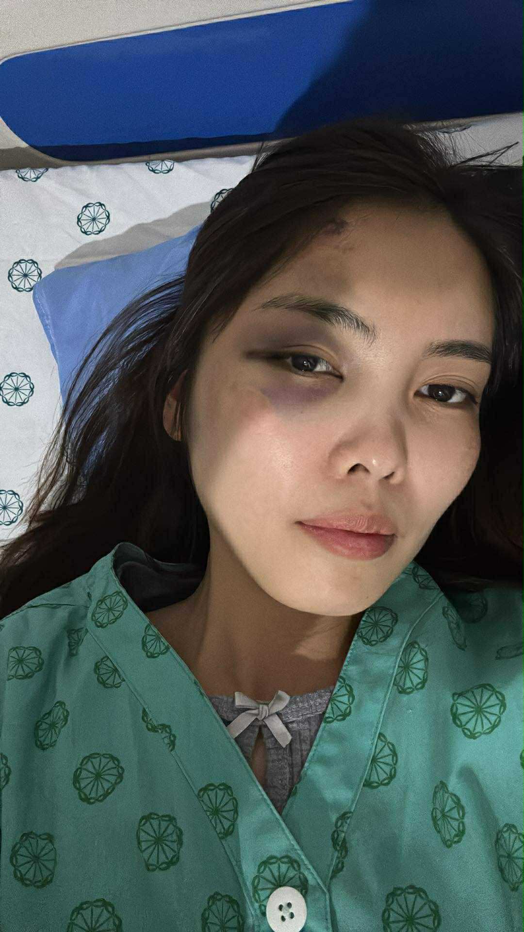 Kinh hãi cảnh chồng lôi vợ ra đánh giữa hành lang chung cư, thủng màng nhĩ, chấn động não ngay trước mắt hàng xóm