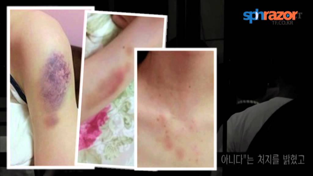 Mãi đến những năm 2022, tòa án mới kết luận phần lớn lời khai của cô Choi là bịa đặt và phán quyết anh thắng kiện