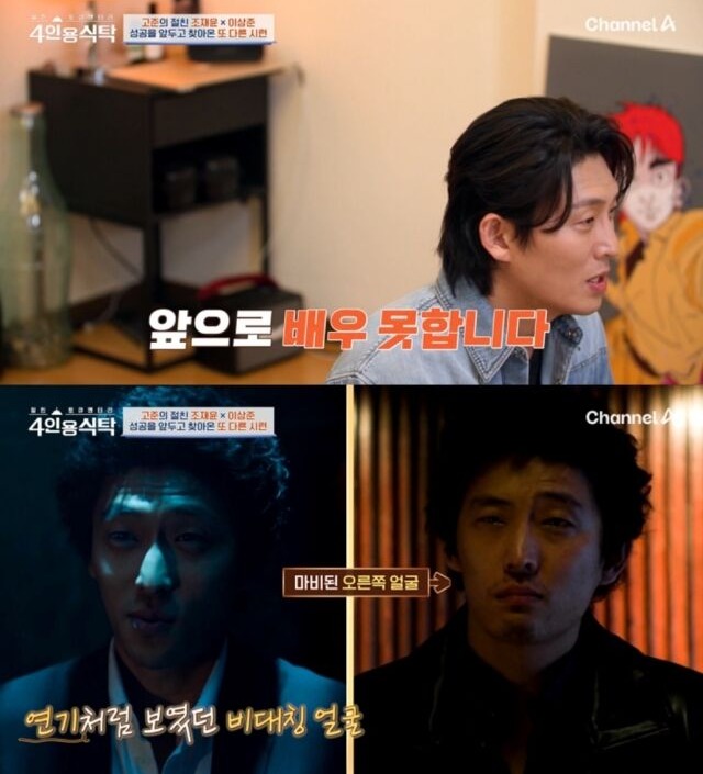 Nam diễn viên diễn xuất với khung dây trong miệng (ảnh: Kbizoom)