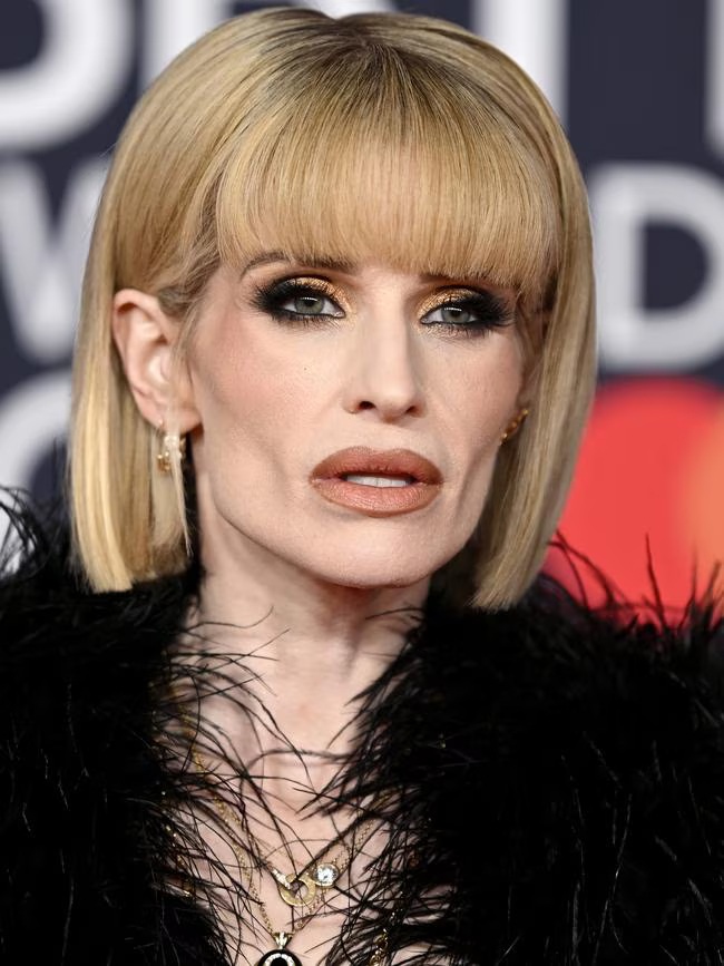 Khuôn mặt hốc hác, thiếu sức sống của Kelly khiến khán giả rùng mình (Ảnh: Getty) 