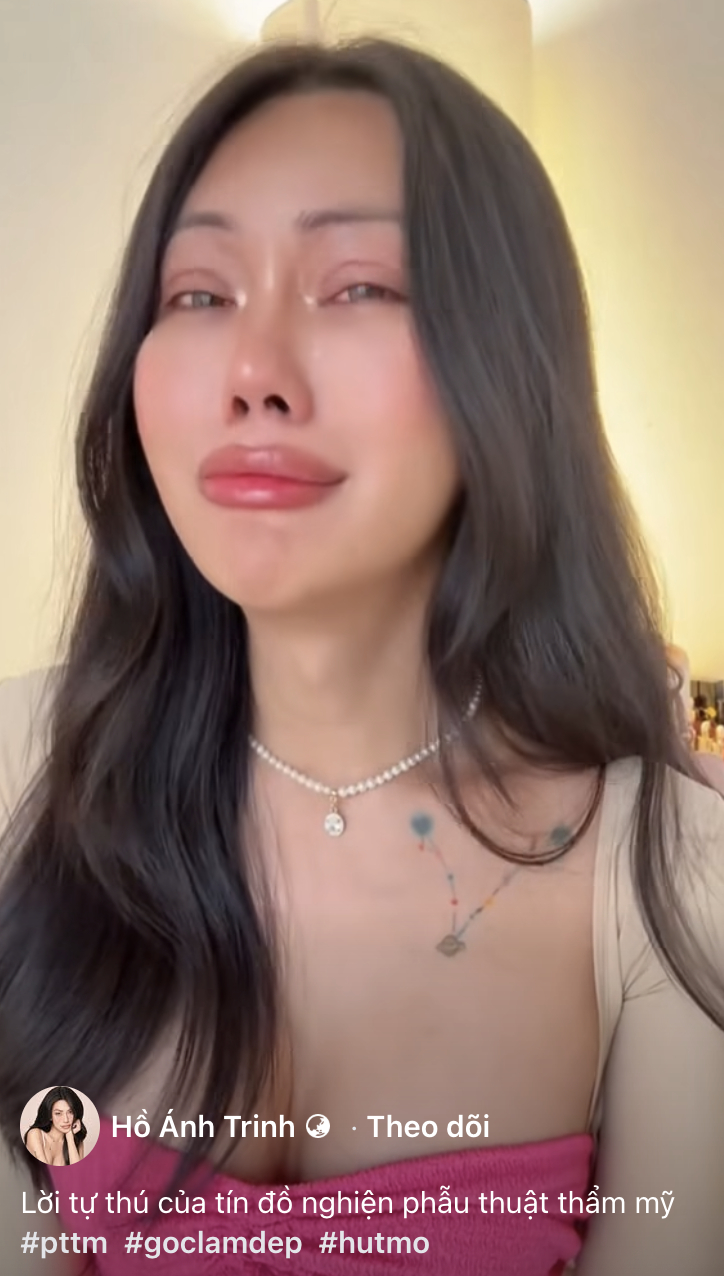 Thời gian đầu sau phẫu thuật, Ánh Trinh liên tục khóc vì gương mặt sưng húp, không còn là chính mình