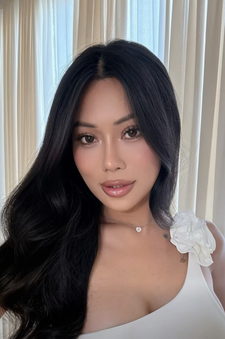 Gương mặt hiện tại của Hồ Ánh Trinh cũng đang dần hồi phục