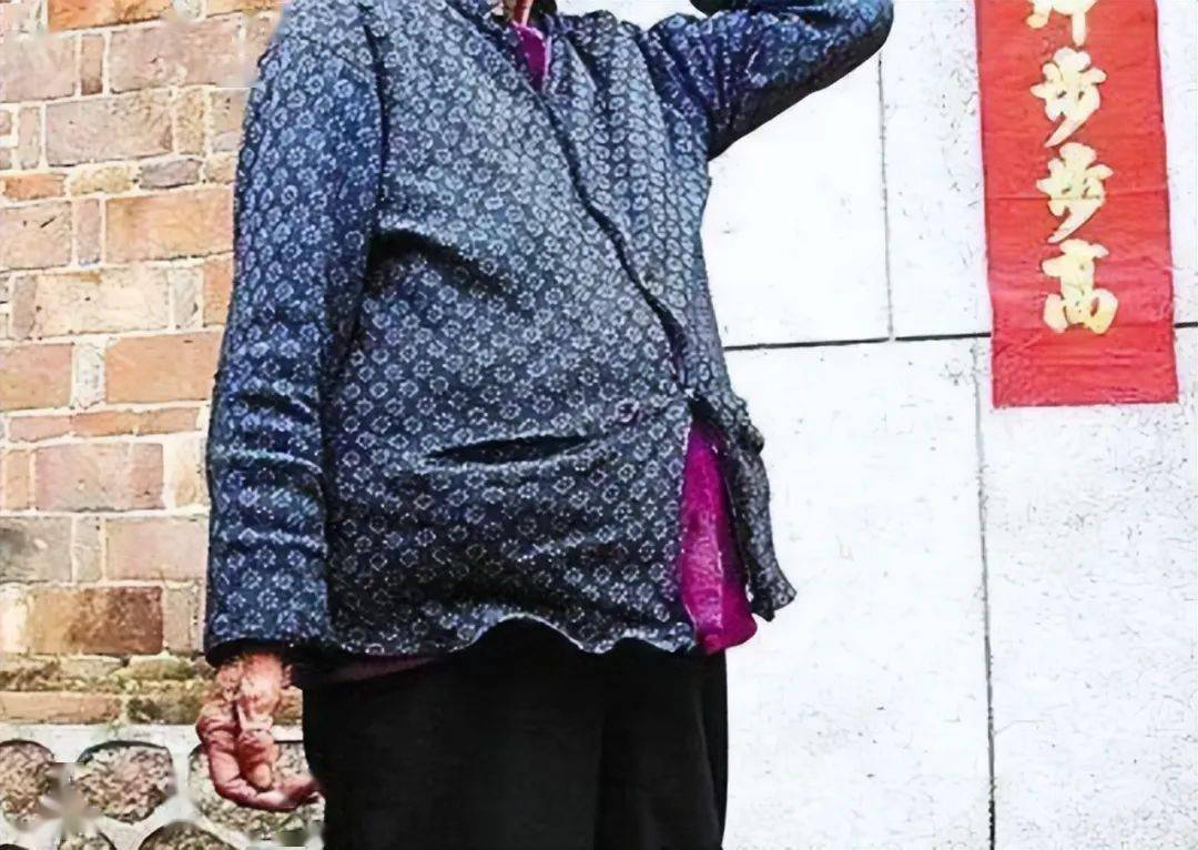 Chiếc bụng lớn đã theo cụ Hoàng suốt nhiều năm nay.