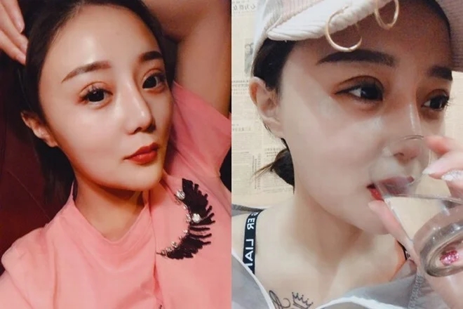 Từng có thời gian cô phẫu thuật thẩm mỹ.