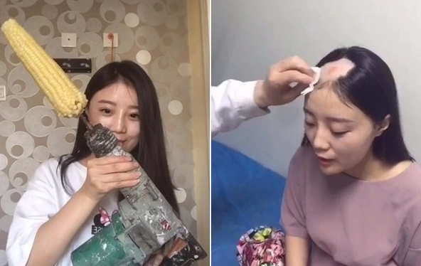 Cuộc sống sang chảnh hiện tại của “cô gái bị hói một mảng đầu vì ăn ngô bằng khoan” 10 năm trước