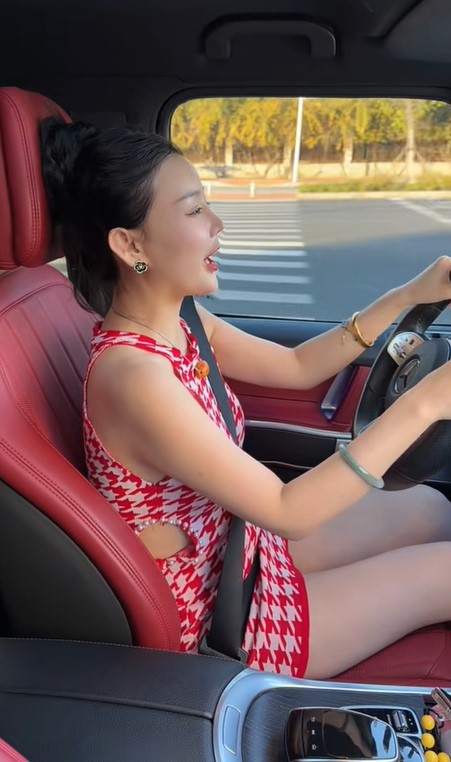 Cuộc sống sang chảnh hiện tại của “cô gái bị hói một mảng đầu vì ăn ngô bằng khoan” 10 năm trước