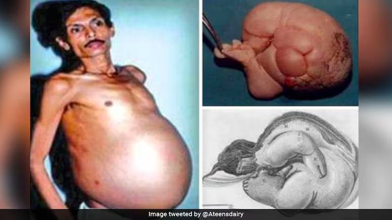 Người đàn ông 60 tuổi 