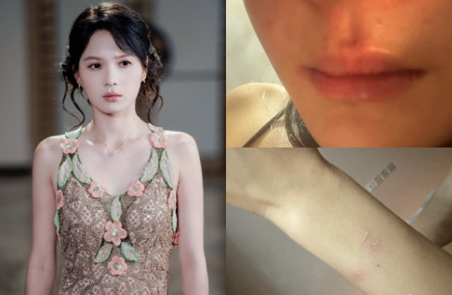 Tả Nhất bị tố cáo ra tay đánh đập trợ lý không thương tiếc sau khi cô gái xin nghỉ việc vì không nổi tính khí của nữ diễn viên. Ảnh: Weibo. 