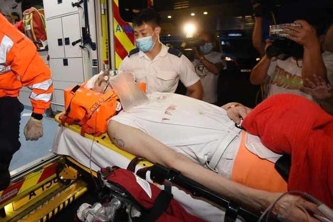 Anh bị chấn thương nặng ở đầu và cổ, xuất huyết não, gãy đốt sống cổ số 4, lệch đốt sống cổ số 5 và liệt tứ chi. Ảnh: On.