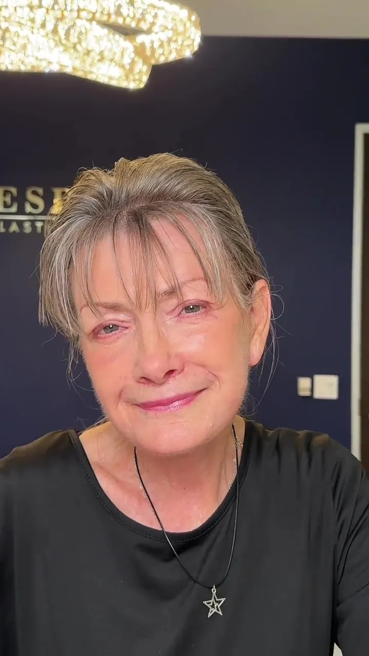 Kết quả sau ca phẫu thuật thành công mỹ mãn, bà lão 70 tuổi được nhận xét đã trẻ ra 20-30 tuổi (Ảnh chụp màn hình)