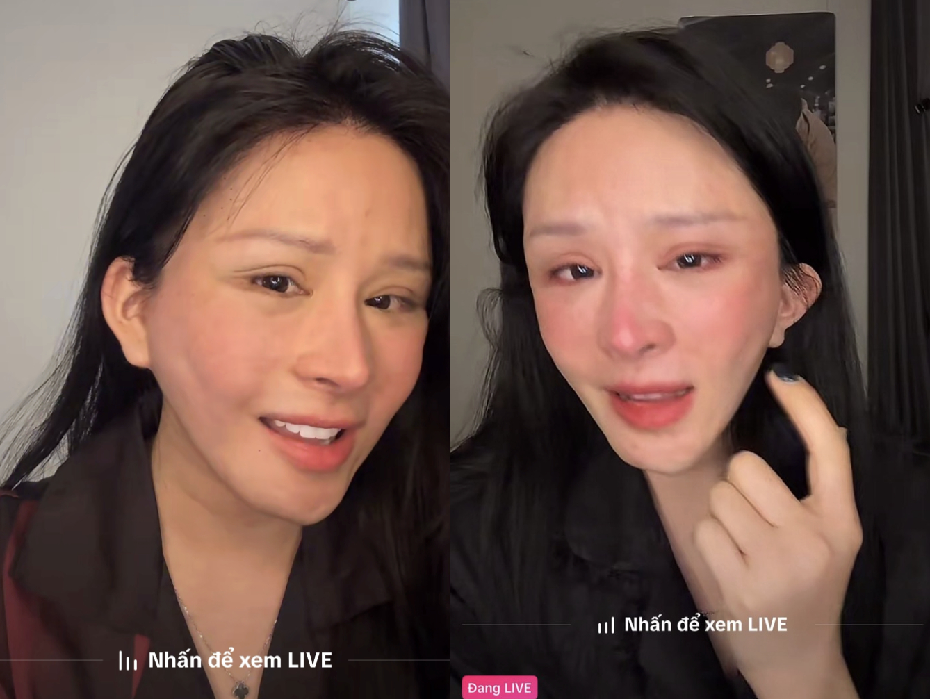  Cô gái từng có ngoại hình xinh đẹp bị biến chứng thẩm mỹ dẫn đến gương mặt méo mó (Ảnh chụp màn hình).