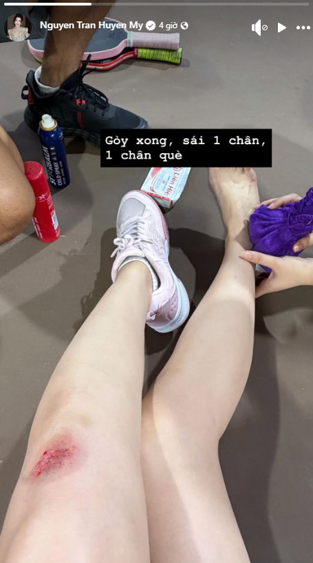 Á hậu Huyền My gặp sự cố khi chơi pickleball. Ảnh: FBNV