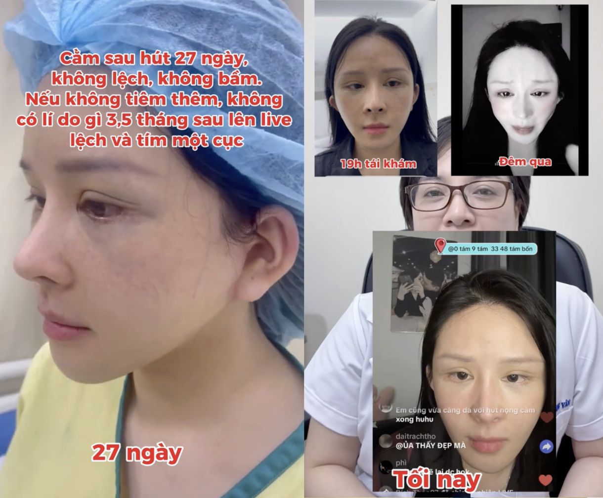 Bác sĩ Hoàng Vân tung loạt bằng chứng từng quá trình, nghi vấn cô gái sử dụng dịch vụ bên thứ 3 trong quá trình điều trị, sử dụng filter biến đổi khuôn mặt (Ảnh: Bác sĩ Hoàng Vân).