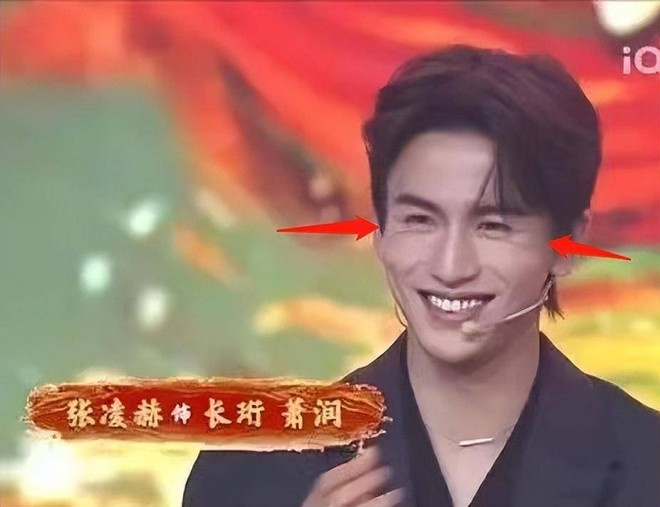 Danh hiệu nam thần thế hệ mới của của Trương Lăng Hách sụp đổ sau khi anh lộ nhan sắc thật. Khi không có lớp filter 