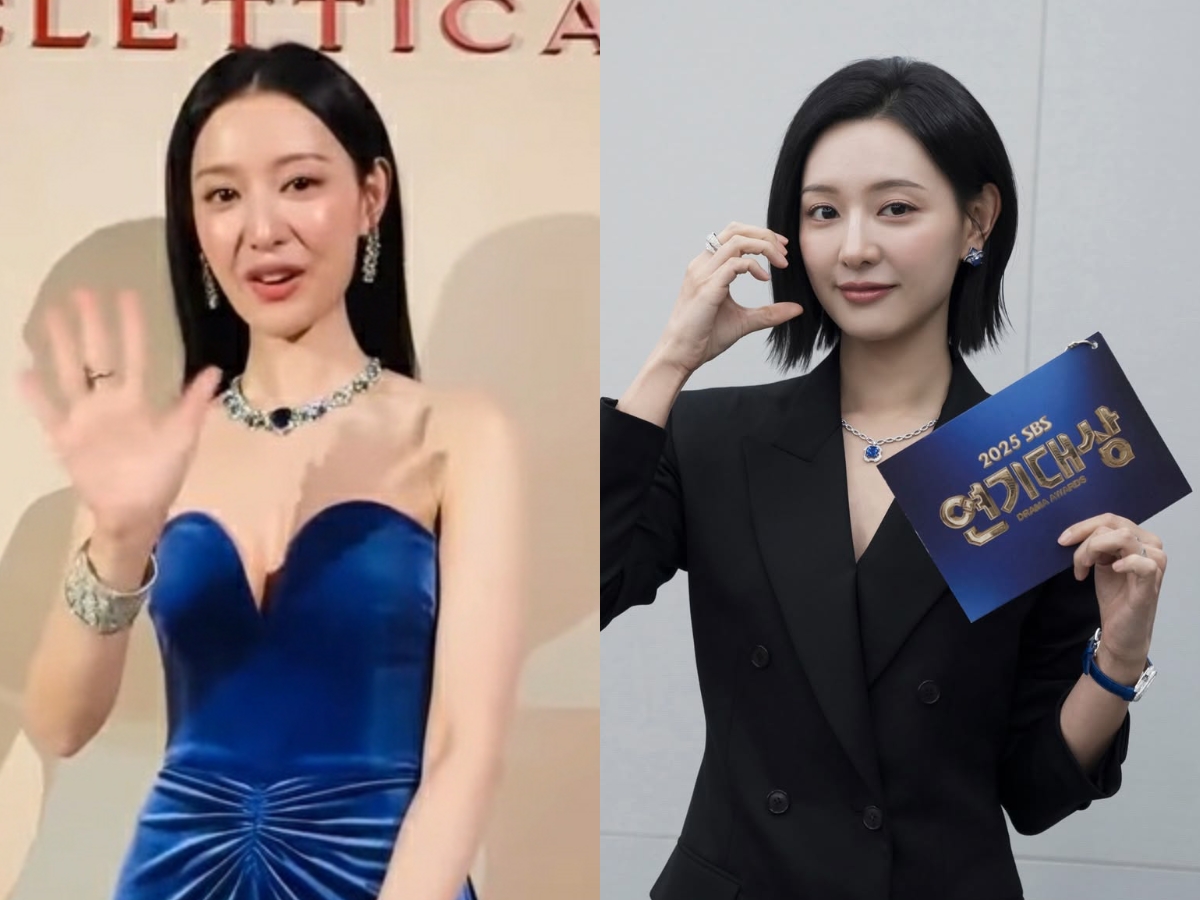 Nữ diễn viên trông gầy gò hơn hẳn so với thời điểm cách đây không lâu (ảnh phải). Ảnh: X