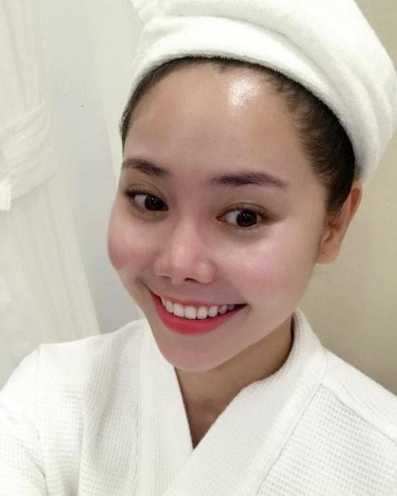 Tường Vi phải sửa mũi 3 lần để sửa chiếc mũi méo mó biến dạng 