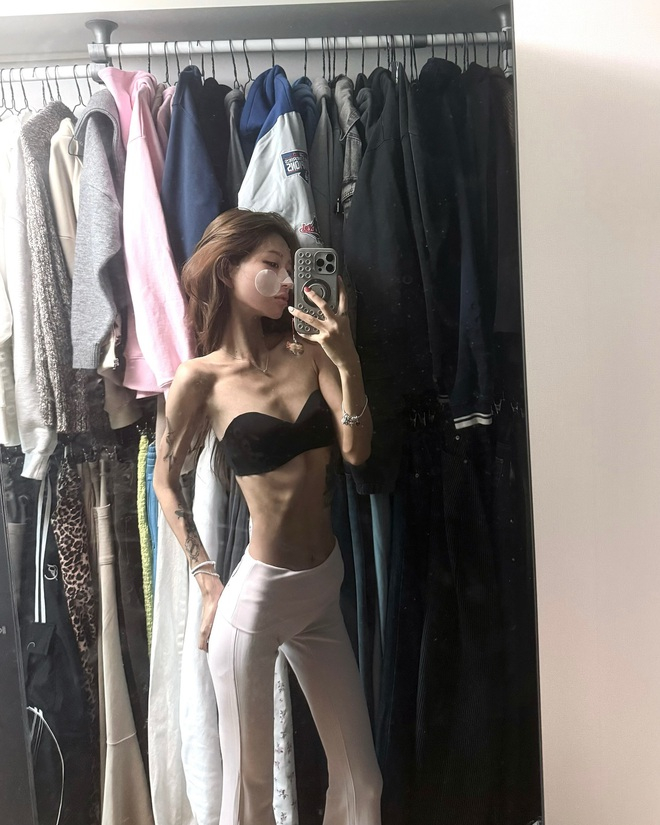 Sau khi chữa khỏi Lupus ban đỏ, Choi Jun Hee giảm tổng cộng khoảng 55 kg, hiện chỉ còn khoảng 41 kg với chiều cao 1m70 (Ảnh IGNV).