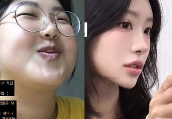 Cô nàng là case study giảm cân liên tục được truyền thông xứ Hàn quan sát, cập nhật (Ảnh IGNV).