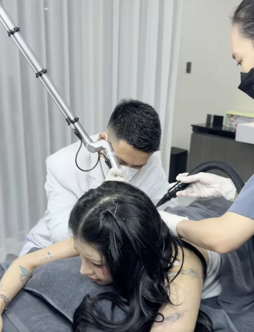 Ciin mới đây đã đi xoá xăm 2 lần (Ảnh: FBNV)