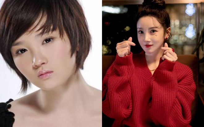 Trần Tiểu Vân can thiệp thẩm mỹ toàn bộ để có gương mặt thời thượng hơn. Ảnh: Sina.