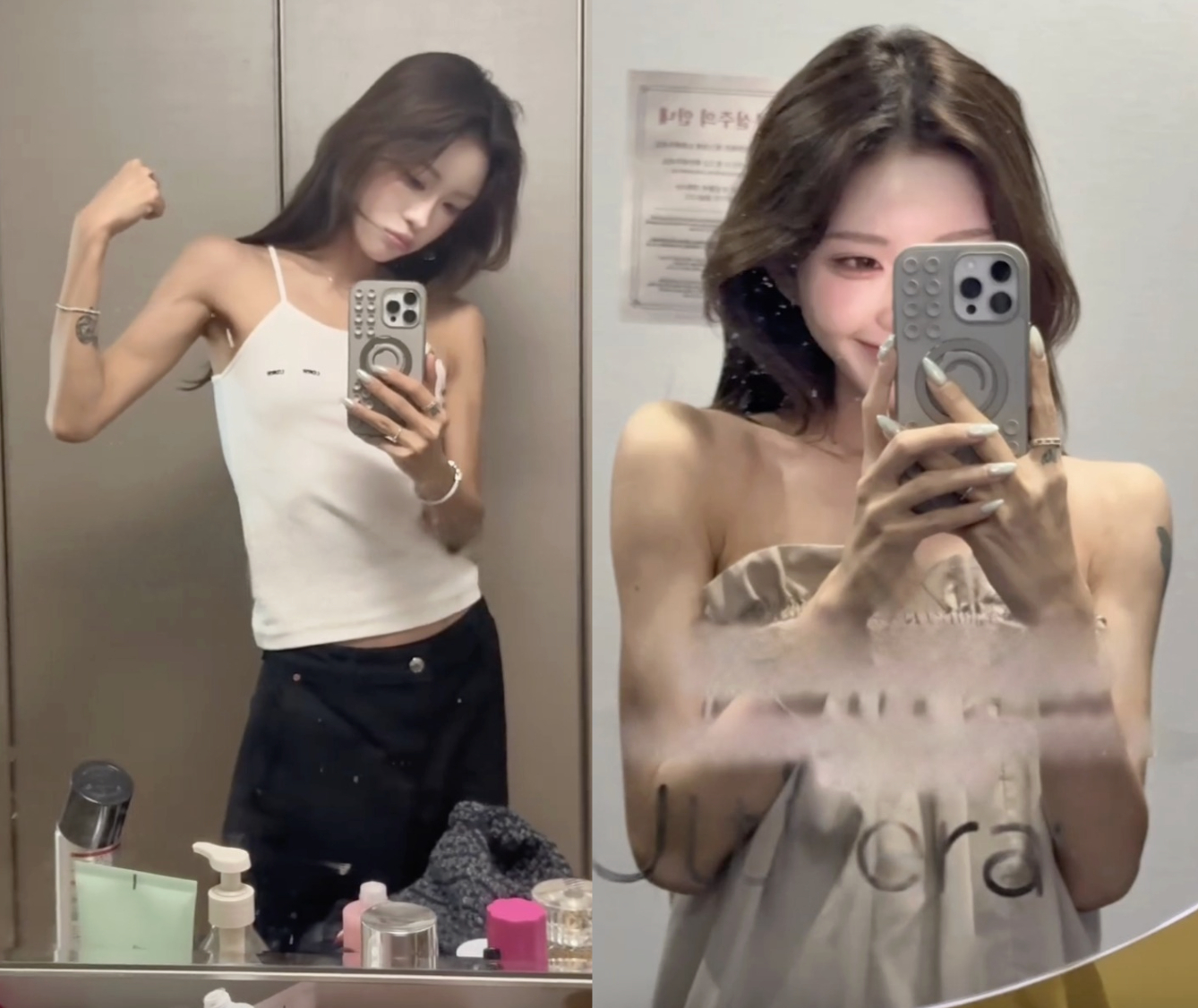 Hình ảnh trước và sau khi chính chủ tiêm filler và botox để tạo vai móc áo giống Jennie (Ảnh chụp màn hình).