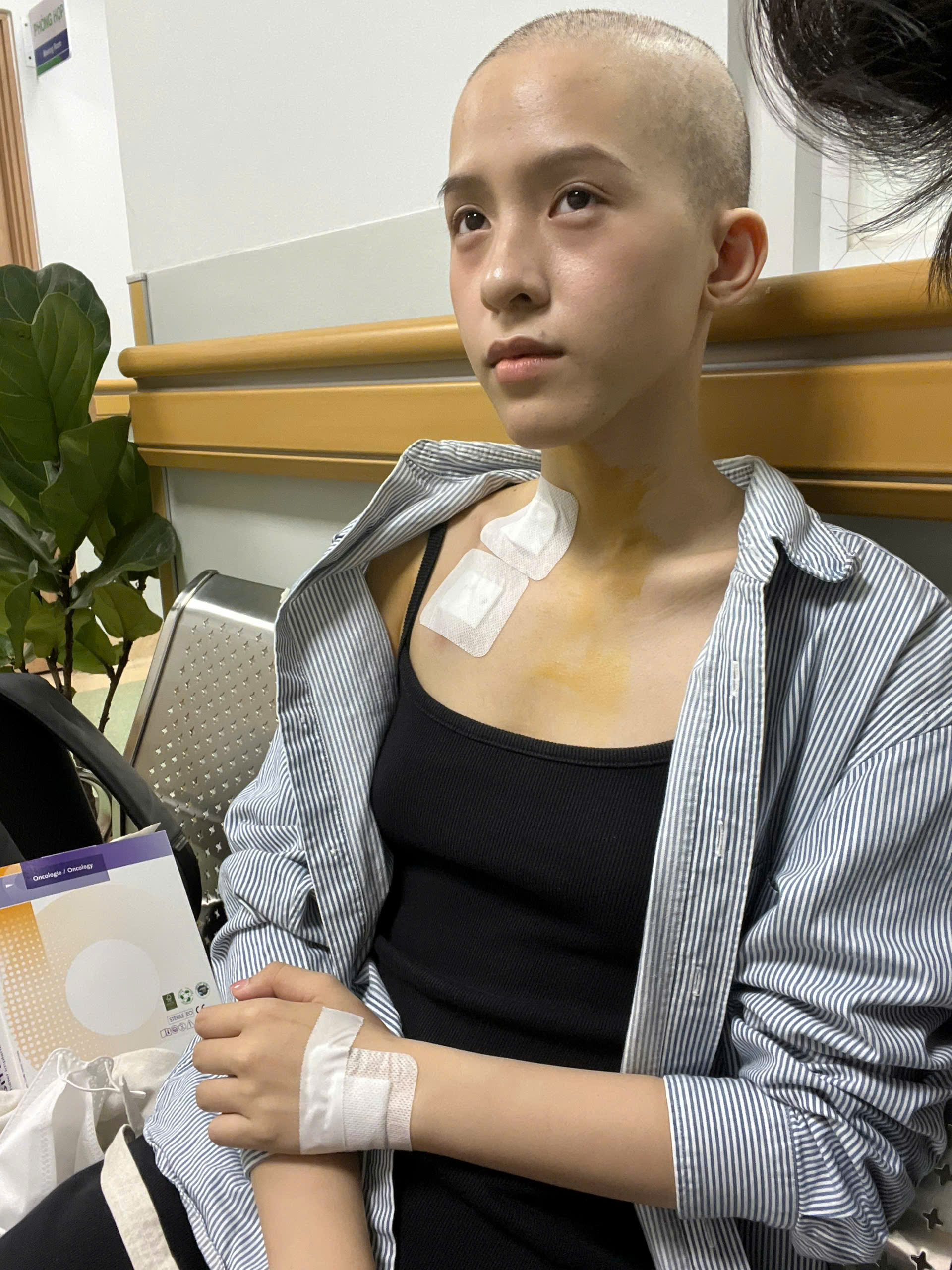 Cô bạn trải qua 6 đợt hóa trị, tự cạo đầu trước khi bị rụng tóc.