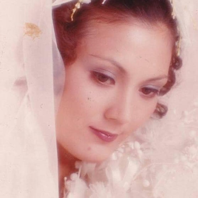 Nữ diễn viên 2 năm trước ngã chấn thương sọ não, nay đột ngột qua đời vì biến chứng viêm phổi