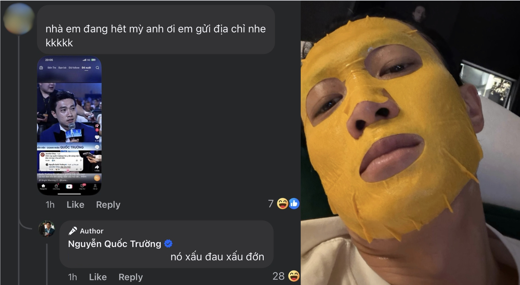 Quốc Trường lên tiếng về khung hình bị mụn