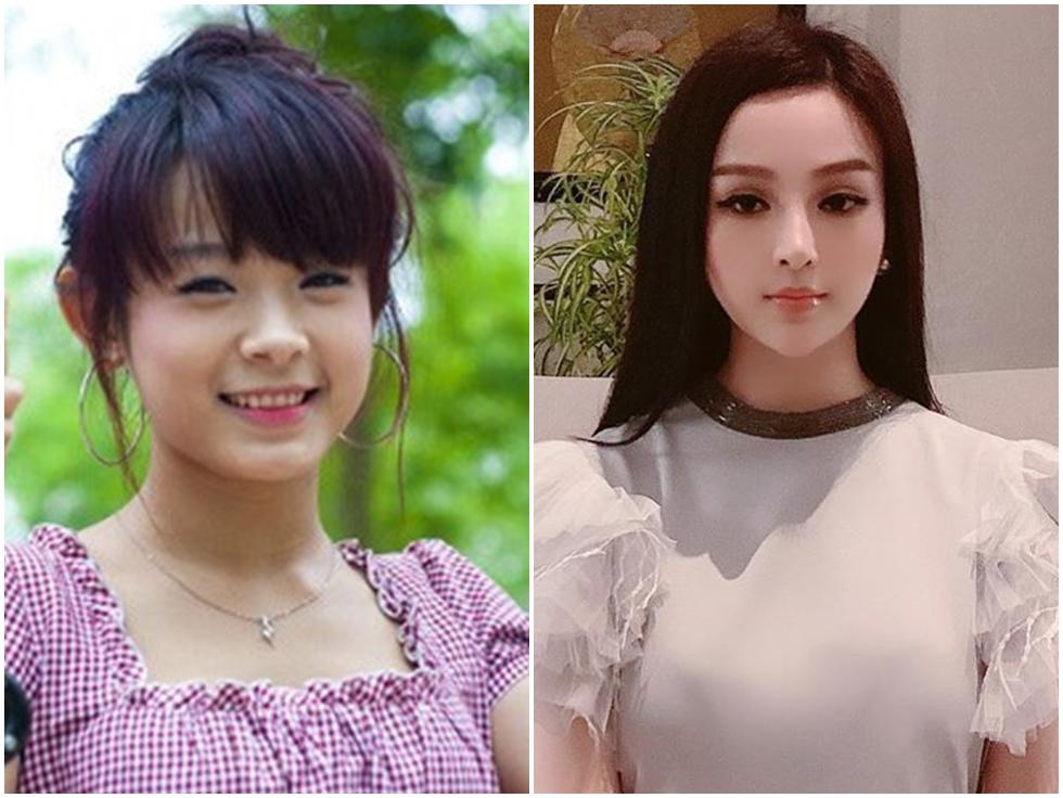 Gương mặt của Huyền Baby bị nhận xét thiếu tự nhiên