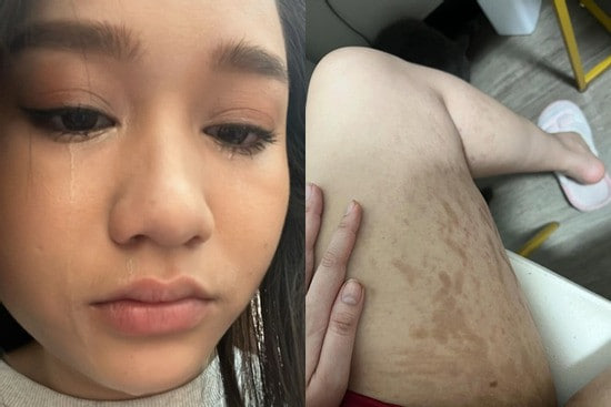 Nữ diễn viên từng chia sẻ hình ảnh da bị rạn do tăng cân đột ngột. (Ảnh: Facebook)