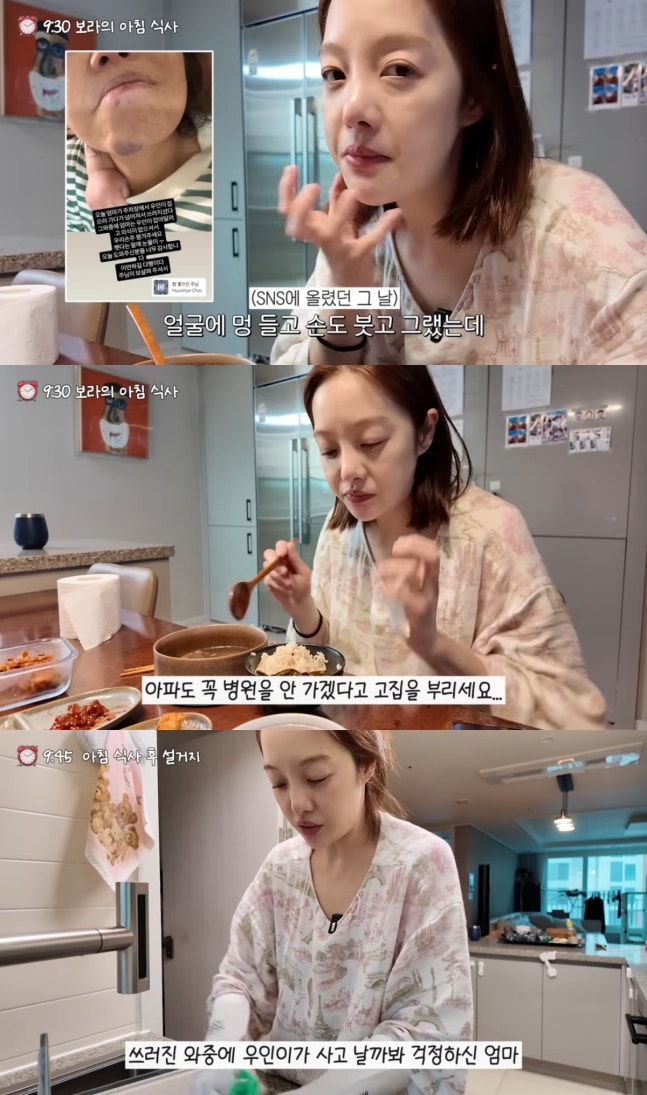 Hwang Bora tiết lộ mẹ cô bị tai nạn khi trông cháu và không chịu đến bệnh viện. Ảnh: Xports News