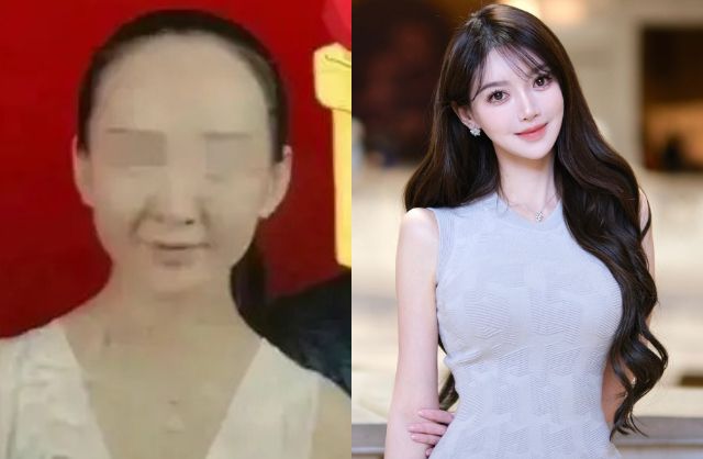 Hình ảnh trước và sau khi thẩm mỹ của Diệp Kha khiến dân tình sốc nặng. Ảnh: Sina. 