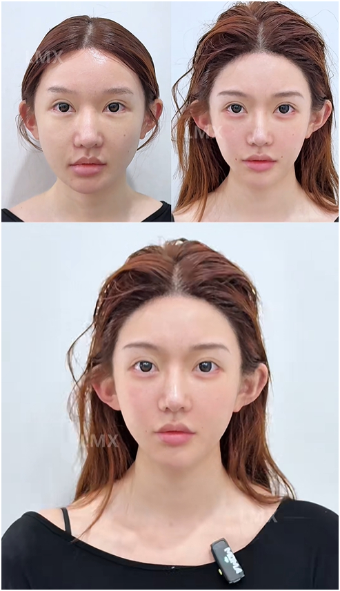  Tất tần tật về xu hướng 