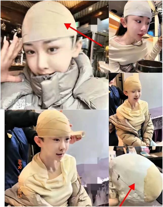 Cô gái này đã 2 lần bơm 