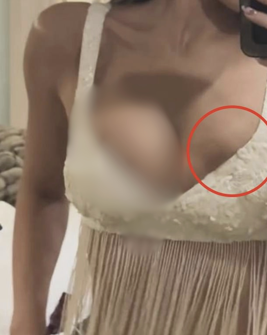 D&acirc;n t&igrave;nh nghi Kylie Jenner bị vỡ t&uacute;i ngực khi bung xo&atilde; cực vui ở Coachella- Ảnh 6.