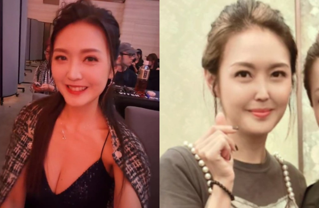 Nàng hậu đi sửa mũi để