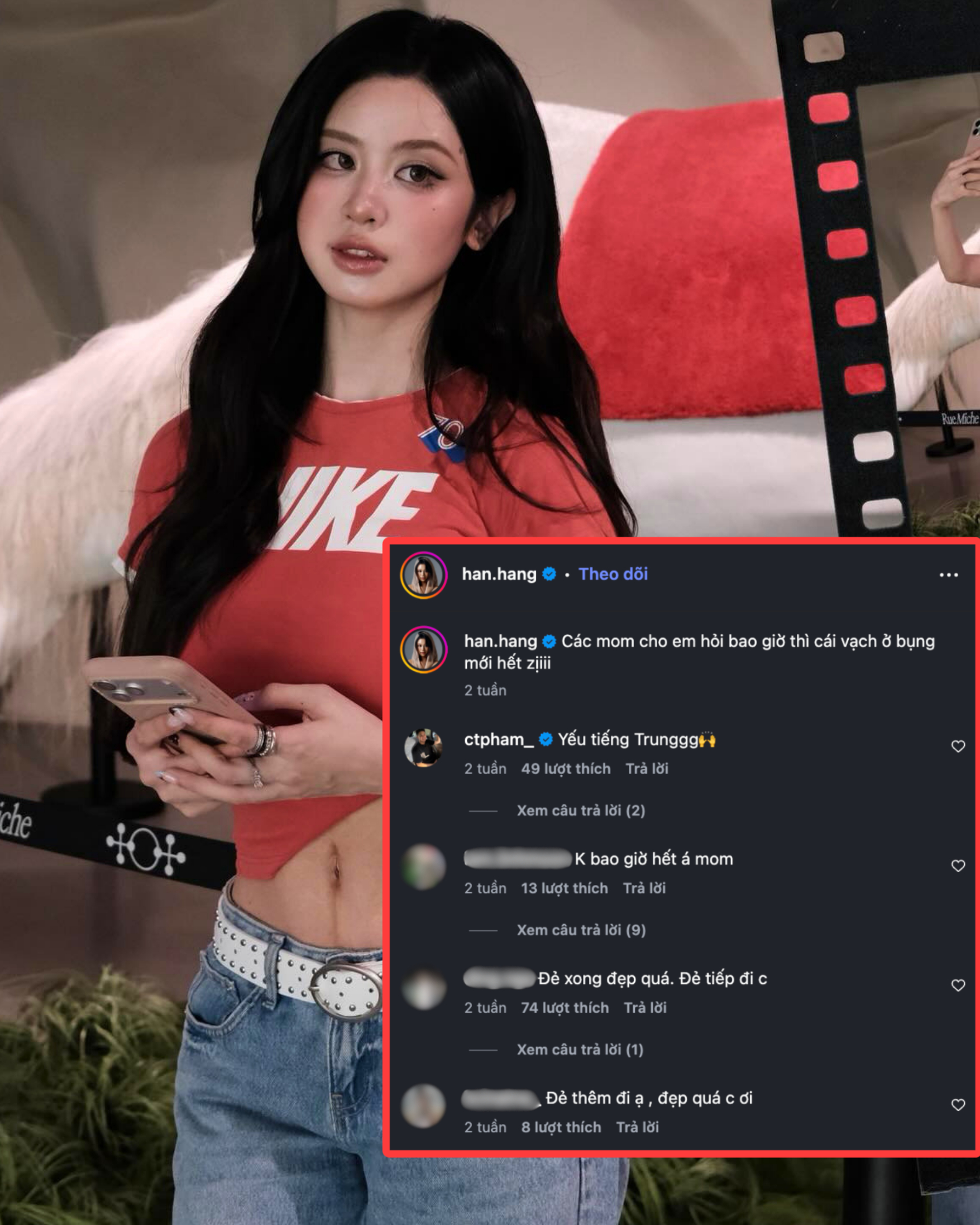 Mẹ bỉm lập topic hỏi thăm vì lấn cấn với đường thai nghén trên bụng chưa chịu mờ đi sau sinh.