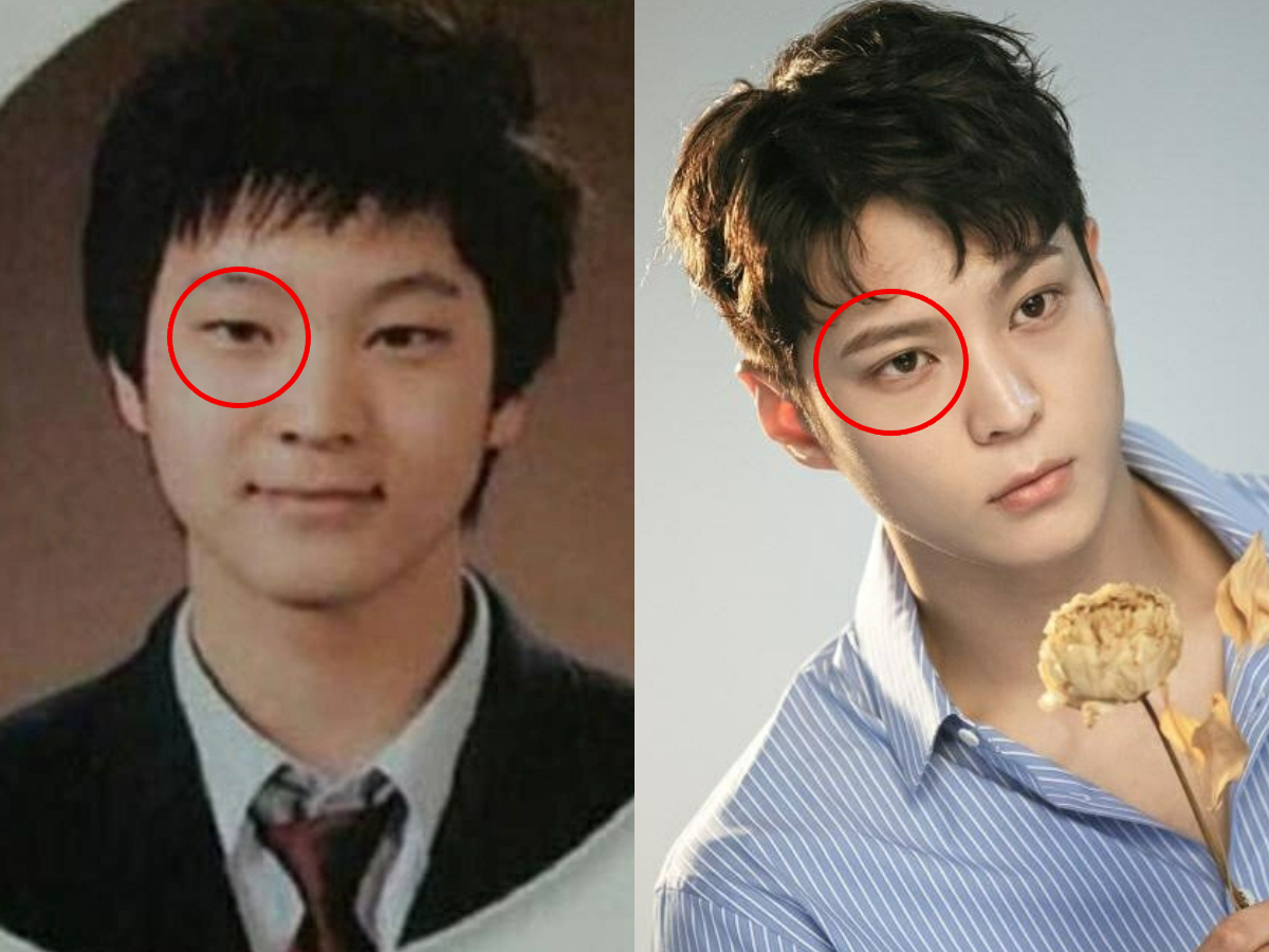 Tài tử Good Doctor từng phẫu thuật thẩm mỹ trong quá khứ để sở hữu đôi mắt 2 mí. Ảnh: Naver