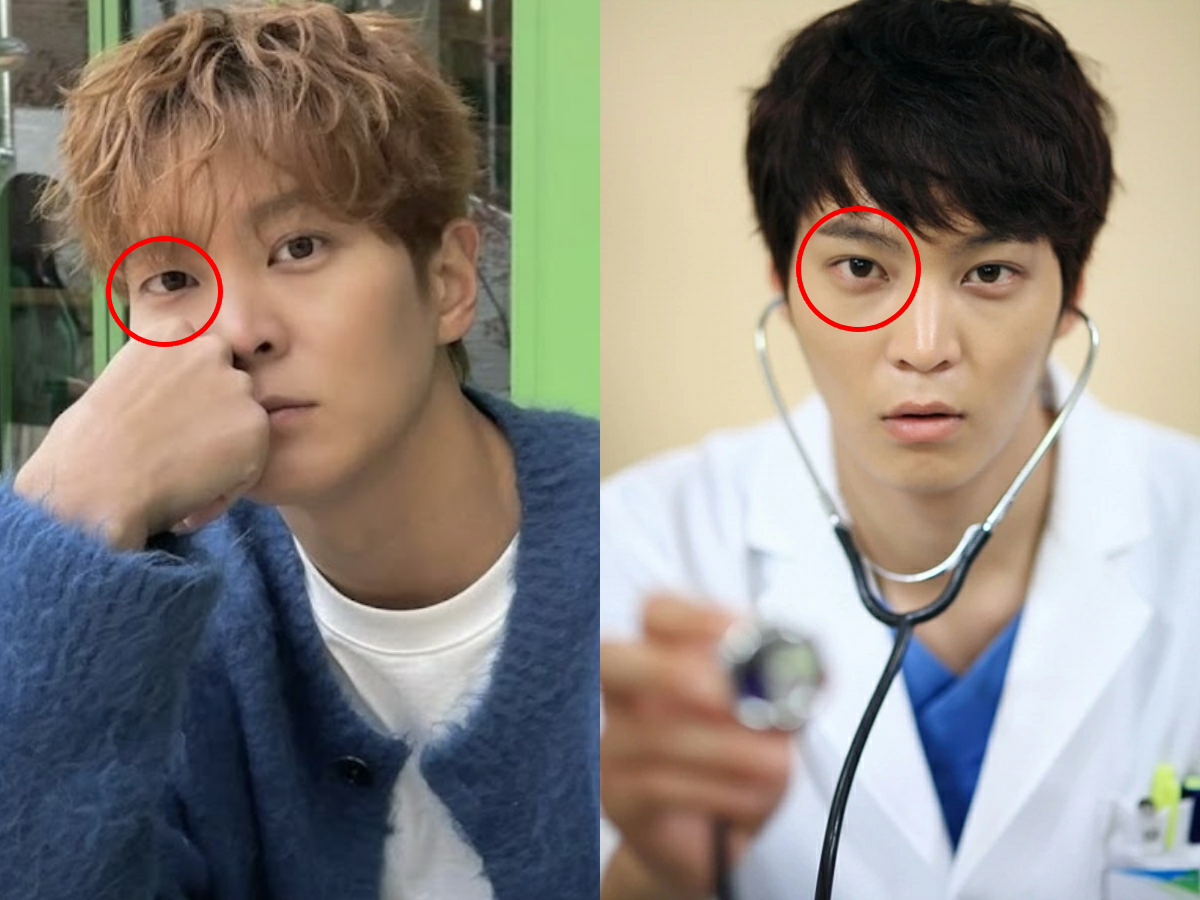 Mắt phải của Joo Won bỗng thay đổi hẳn so với trước kia (hình phải). Giờ đây, mắt phải của mỹ nam sinh năm 1987 bỗng không còn nếp gấp mí. Ảnh: Koreaboo