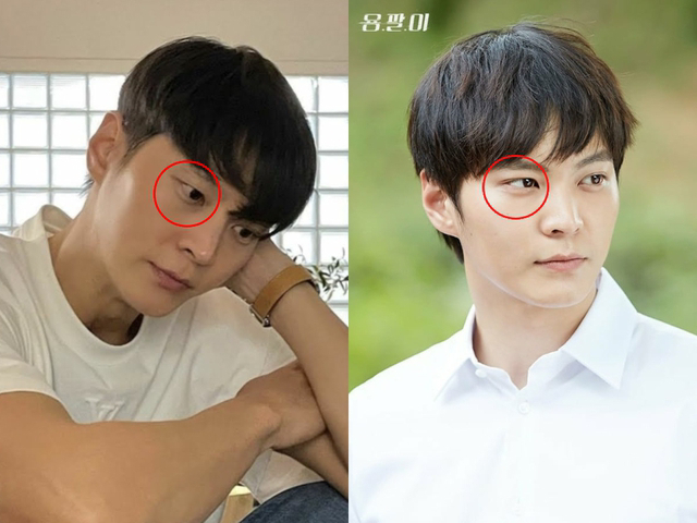 Tờ Koreaboo nhận định, mắt tài tử trở về trạng thái ban đầu 1 cách tự nhiên, không phải do đụng chạm “dao kéo” mà thành. Ảnh: Koreaboo