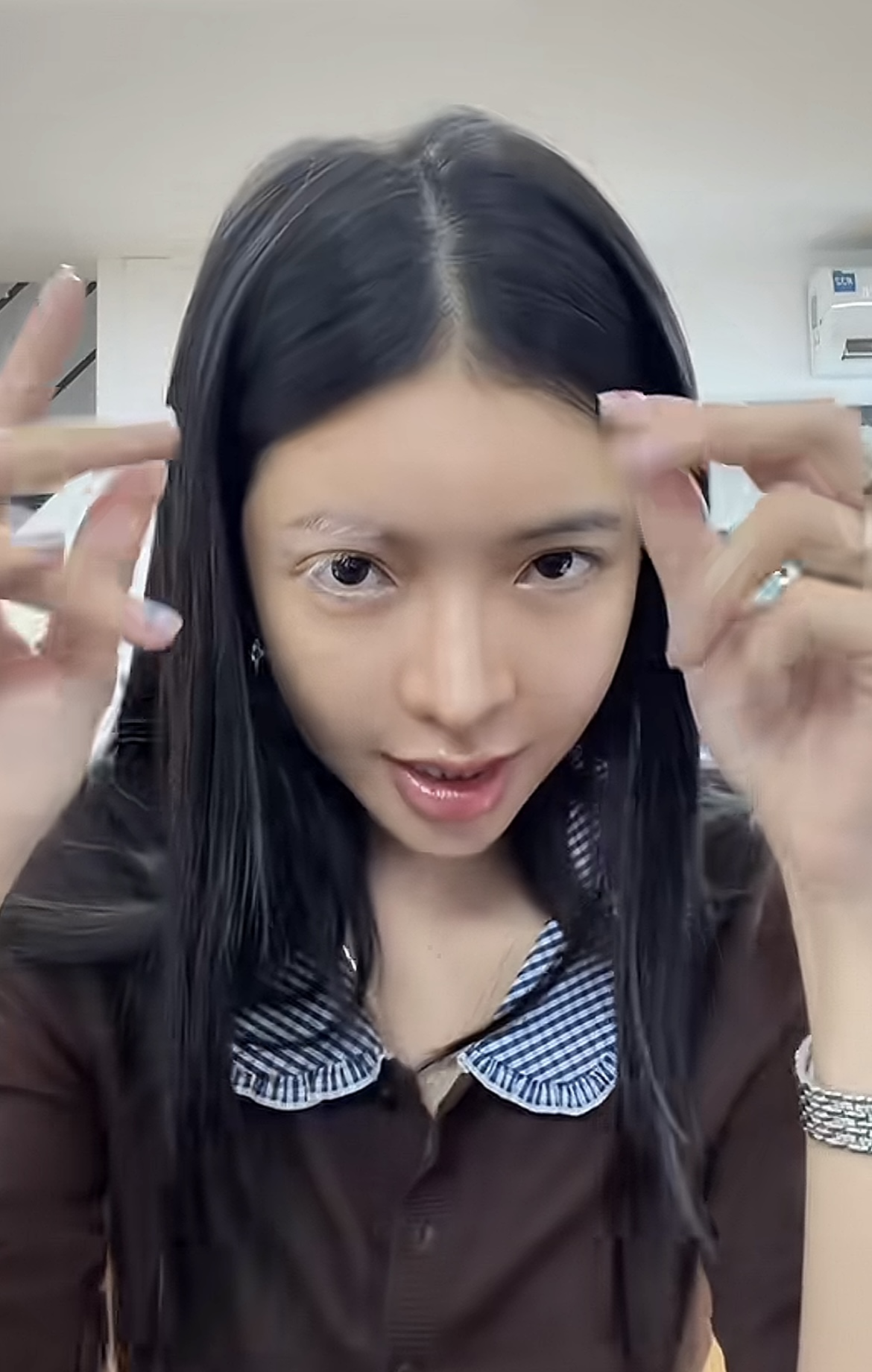 Người đẹp sinh năm 1997 cho biết cô mắc bệnh bạch biến