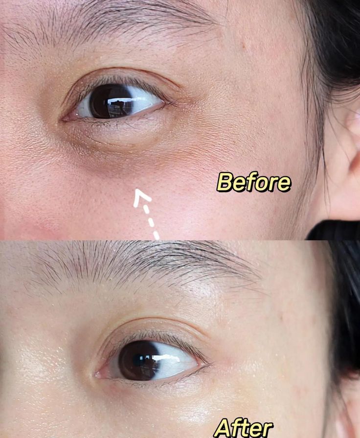 1 bí quyết giúp da “hồi sinh”, trẻ ra ít nhất 3 tuổi xuân