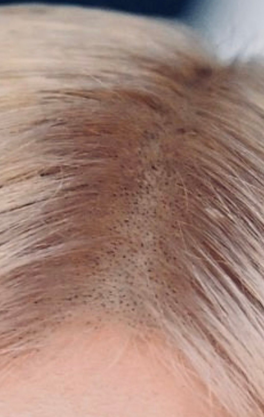 Mái tóc của Rosé đang trong tình trạng đáng báo động. Nguồn: Facebook.