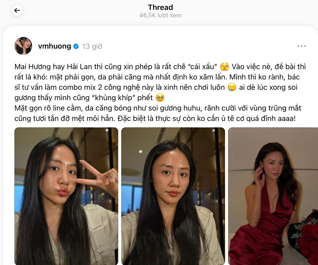 Văn Mai Hương chia sẻ thành quả mỹ mãn khi sử dụng liệu trình làm đẹp không xâm lấn. Nữ ca sĩ cũng chia sẻ thành quả này sẽ còn đẹp hơn nữa trong 1-2 tuần tới.