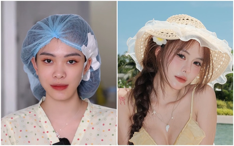 Hà Môi “đắp tiền lên mặt” để sửa những gì? Còn chiếc mũi “đang hếch dần và méo” giờ ra sao?