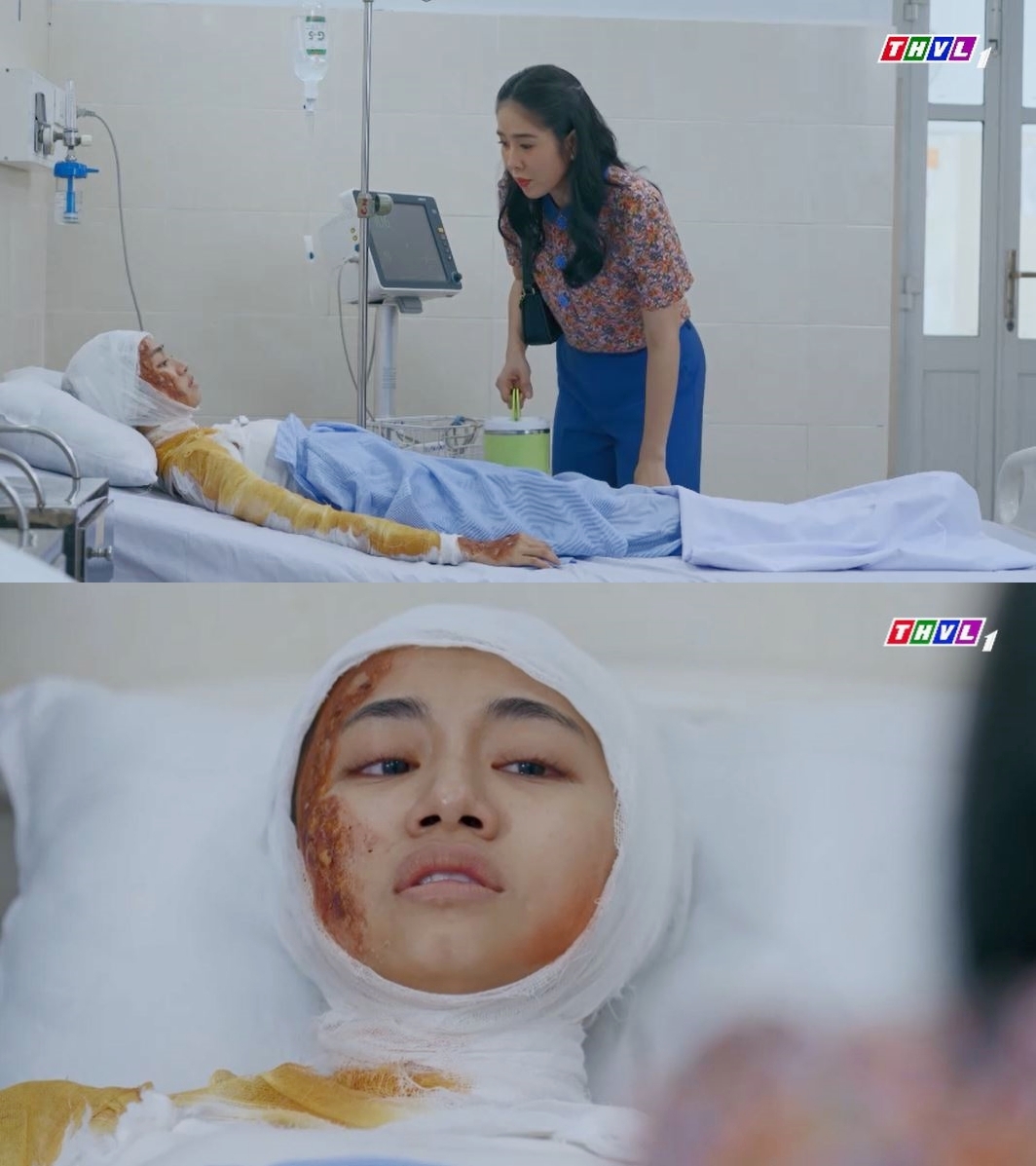 Trang bị bỏng nặng, được Mai chăm sóc