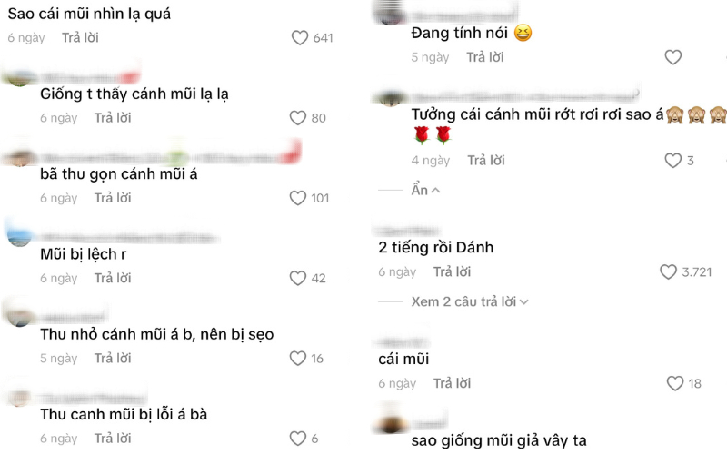 Chiếc mũi khác lạ của Uyển Ân khiến netizen không khỏi thắc mắc.